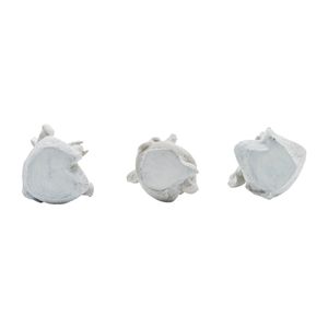 YATESWORTH SET OF 3 WHITE DECOR 8 (IN) 7